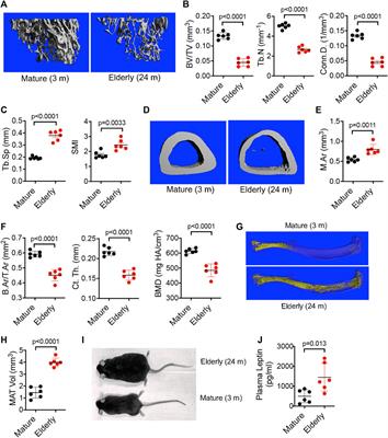 Novel role for alpha-2-macroglobulin (A2M) as a disease modifying protein in senile osteoporosis